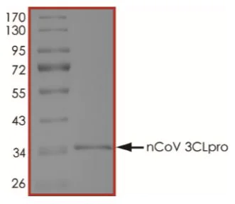 SDS-PAGE - Recombinant human coronavirus SARS-CoV-2 3CL protease protein (Active) (AB277614)