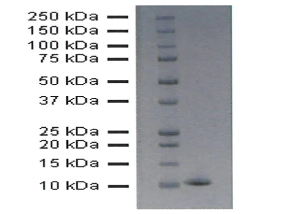 SDS-PAGE - Recombinant Human coronavirus SARS-COV-2 Nsp7 protein (AB283859)