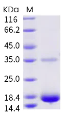SDS-PAGE - Recombinant Human coronavirus SARS-CoV-2 nsp9 protein (Tagged) (AB289608)