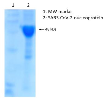 SDS-PAGE - Recombinant Human coronavirus SARS-CoV-2 Nucleocapsid Protein (His tag) (AB272107), expandable thumbnail