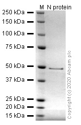 SDS-PAGE - Recombinant Human coronavirus SARS-CoV-2 nucleocapsid protein (His tag) (ab273530), expandable thumbnail