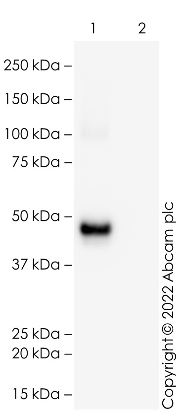 Western blot - Recombinant Human coronavirus SARS-CoV-2 nucleocapsid protein (His tag) (ab273530), expandable thumbnail