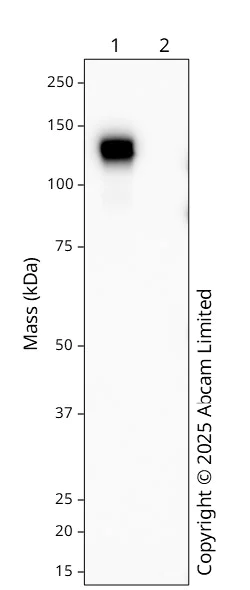 Western blot - Recombinant Human coronavirus SARS-CoV-2 nucleocapsid protein (His tag) (AB273530)