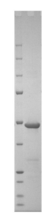 Recombinant Human coronavirus SARS-CoV-2 nucleocapsid protein (His tag)