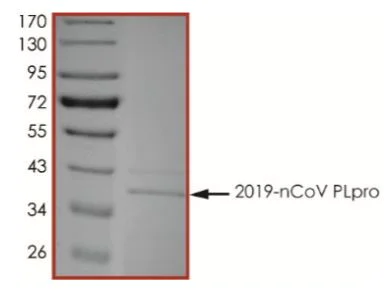 SDS-PAGE - Recombinant human coronavirus SARS-CoV-2 PLpro protein (Active) (AB277615)
