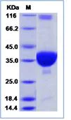 SDS-PAGE - Recombinant Human coronavirus SARS-CoV-2 PLpro protein (His tag) (AB276740)