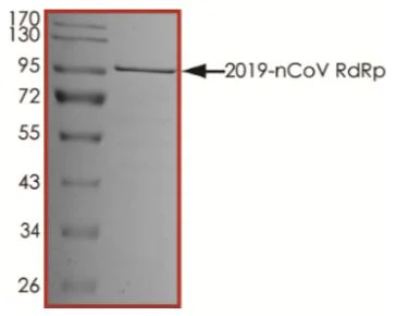 SDS-PAGE - Recombinant human coronavirus SARS-CoV-2 RNA-dependent RNA polymerase (RDRP) protein (Active) (AB277617)
