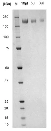 SDS-PAGE - Recombinant Human coronavirus SARS-CoV-2 spike glycoprotein (His tag) (AB281471)