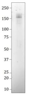 Recombinant Human coronavirus SARS-CoV-2 spike glycoprotein (mutated D614G) (His tag)