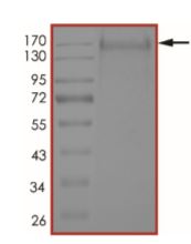 SDS-PAGE - Recombinant human coronavirus SARS-CoV-2 Spike Glycoprotein S1 (Active) (AB273067), expandable thumbnail