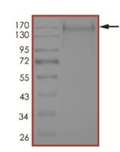 SDS-PAGE - Recombinant human coronavirus SARS-CoV-2 Spike Glycoprotein S1 (Active) (AB273067)