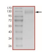 SDS-PAGE - Recombinant human coronavirus SARS-CoV-2 Spike Glycoprotein S1 (Active) (ab273068), expandable thumbnail