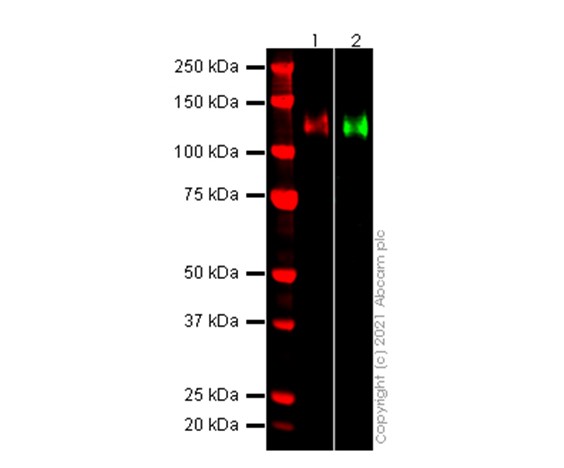 Western blot - Recombinant human coronavirus SARS-CoV-2 Spike Glycoprotein S1 (Active) (AB273068), expandable thumbnail