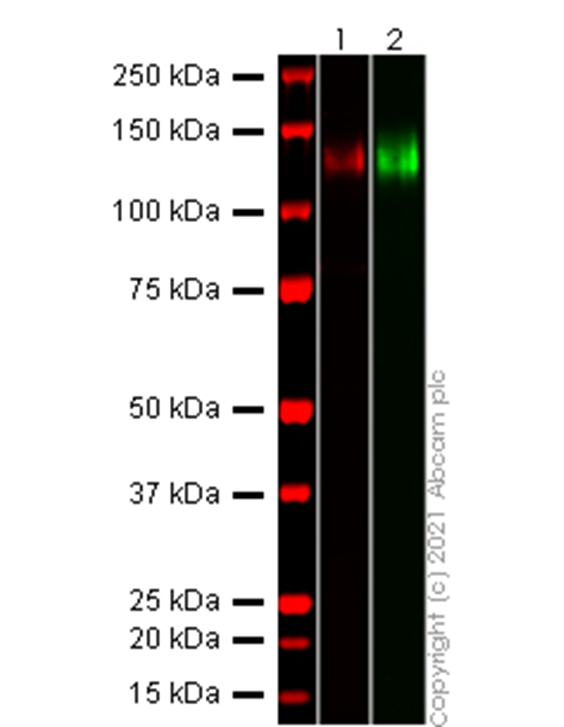 Western blot - Recombinant human coronavirus SARS-CoV-2 Spike Glycoprotein S1 (Active) (ab273068), expandable thumbnail