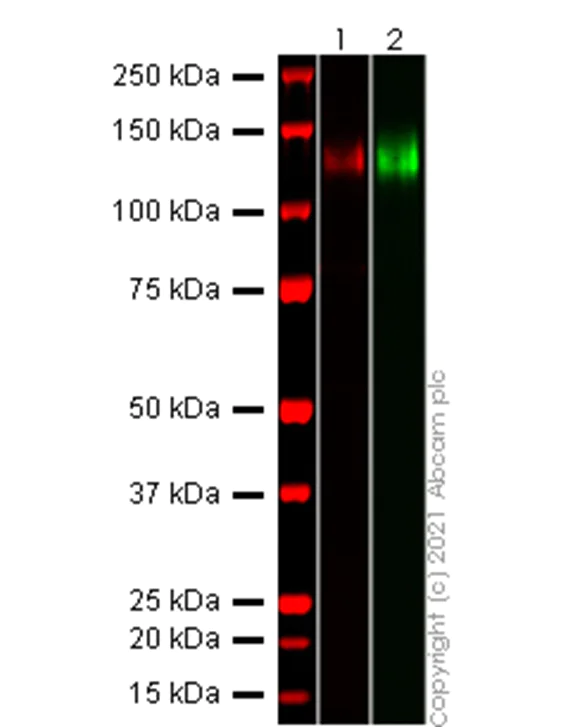 Western blot - Recombinant human coronavirus SARS-CoV-2 Spike Glycoprotein S1 (Active) (AB273068)