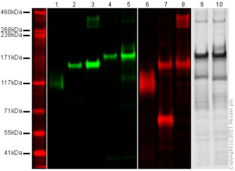 Western blot - Recombinant human coronavirus SARS-CoV-2 Spike Glycoprotein S1 (Active) (ab273068), expandable thumbnail