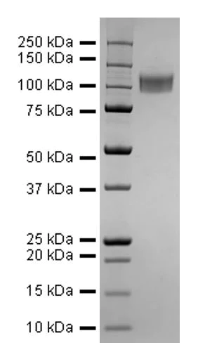 SDS-PAGE - Recombinant Human coronavirus SARS-CoV-2 Spike Glycoprotein S1 (His tag) (AB275927)