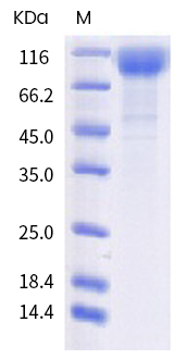Recombinant human coronavirus SARS-CoV-2 Spike Glycoprotein S1 (mut W152C + L452R + D614G) (Active)