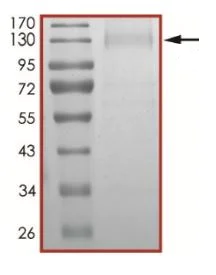 SDS-PAGE - Recombinant human coronavirus SARS-CoV-2 Spike Glycoprotein S1 (mutated D614G) (Active) (AB281470)