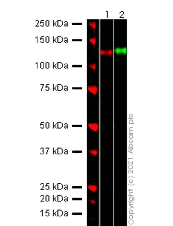 Western blot - Recombinant Human coronavirus SARS-CoV-2 Spike Glycoprotein S2 (Fc Chimera) (AB272106), expandable thumbnail