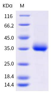 SDS-PAGE - Recombinant human coronavirus SARS-CoV-2 Spike RBD (mutated E484Q) protein (Active) (AB289615)