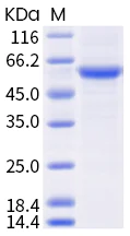 SDS-PAGE - Recombinant Human coronavirus SARS-CoV-2 Spike RBD (mutated K417N + E484K + N501Y) protein (AB289611)