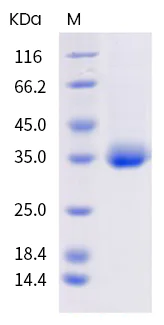SDS-PAGE - Recombinant human coronavirus SARS-CoV-2 Spike RBD (mutated K417N + E484K + N501Y) protein (Active) (AB289609)