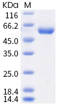 SDS-PAGE - Recombinant Human coronavirus SARS-CoV-2 Spike RBD (mutated K417N) protein (Tagged) (AB289612)