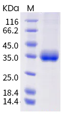 SDS-PAGE - Recombinant human coronavirus SARS-CoV-2 Spike RBD (mutated K417T + E484K + N501Y) protein (Active) (AB289616)