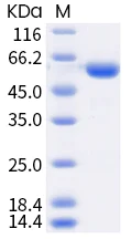 SDS-PAGE - Recombinant Human coronavirus SARS-CoV-2 Spike RBD (mutated K417T + E484K + N501Y) protein (Tagged) (AB289617)