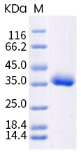 Recombinant human coronavirus SARS-CoV-2 Spike RBD (mutated L452R + E484Q) protein (Active)
