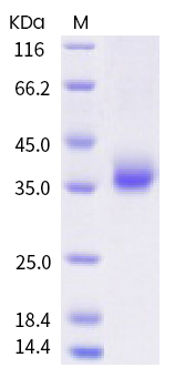 Recombinant human coronavirus SARS-CoV-2 Spike RBD (mutated L452R) protein (Active)