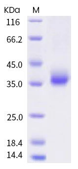 SDS-PAGE - Recombinant human coronavirus SARS-CoV-2 Spike RBD (mutated L452R) protein (Active) (AB289614)