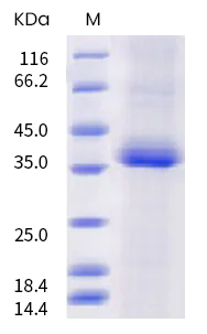 SDS-PAGE - Recombinant Human coronavirus SARS-CoV-2 Spike RBD (mutated S477N + E484K) protein (His tag) (AB289631)