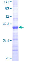 SDS-PAGE - Recombinant Human Coronin 1a/TACO protein (GST tag N-Terminus) (AB161325)