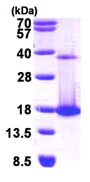 SDS-PAGE - Recombinant Human COTL1 protein (His tag N-Terminus) (AB116193)