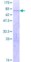 SDS-PAGE - Recombinant Human COUP TF1 protein (AB152739), expandable thumbnail