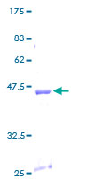 SDS-PAGE - Recombinant Human COX IV protein (AB112273)