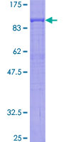 Recombinant Human COX2 / Cyclooxygenase 2 protein