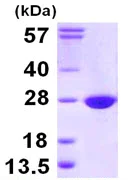 SDS-PAGE - Recombinant Human COX4NB protein (His tag N-Terminus) (AB111626)