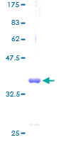 Recombinant Human COX6B1 protein