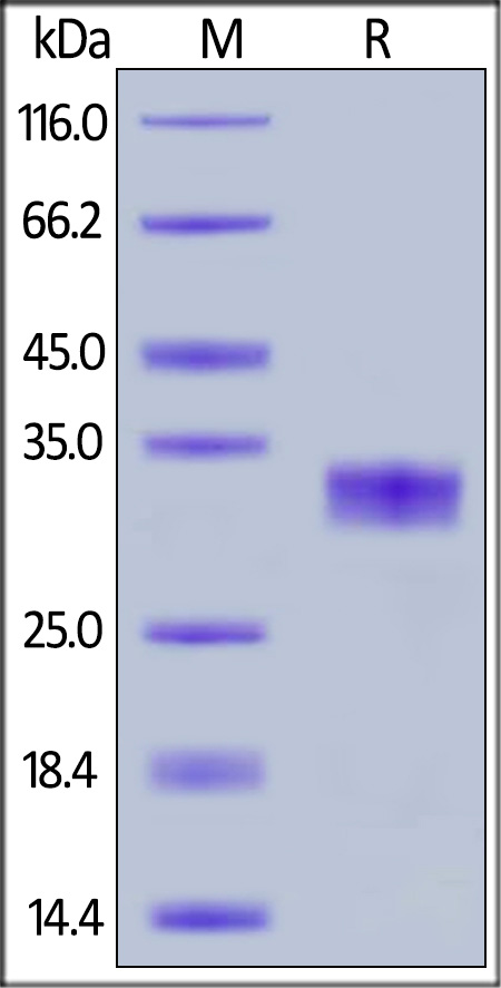 SDS-PAGE - Recombinant human Coxsackie Adenovirus Receptor/hCAR protein (His tag) (AB168893), expandable thumbnail