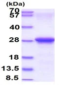 SDS-PAGE - Recombinant Human Coxsackie Adenovirus Receptor/hCAR protein (His tag N-Terminus) (AB168070)