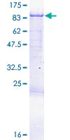 SDS-PAGE - Recombinant Human CPEB3 protein (AB153194)