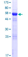 Recombinant Human CPEB4 protein