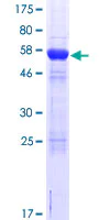 SDS-PAGE - Recombinant Human CPEB4 protein (AB164250)