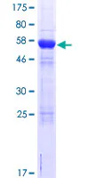 SDS-PAGE - Recombinant Human CPEB4 protein (GST tag N-Terminus) (AB164250)