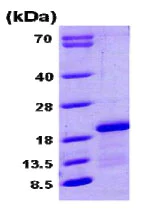 SDS-PAGE - Recombinant Human CPLX1 protein (AB79148)