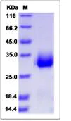 SDS-PAGE - Recombinant Human CPLX3 protein (His tag) (AB276620)