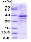 SDS-PAGE - Recombinant Human CPPED1 protein (His tag N-Terminus) (AB156722)